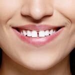 snap-on-smile-6.jpg